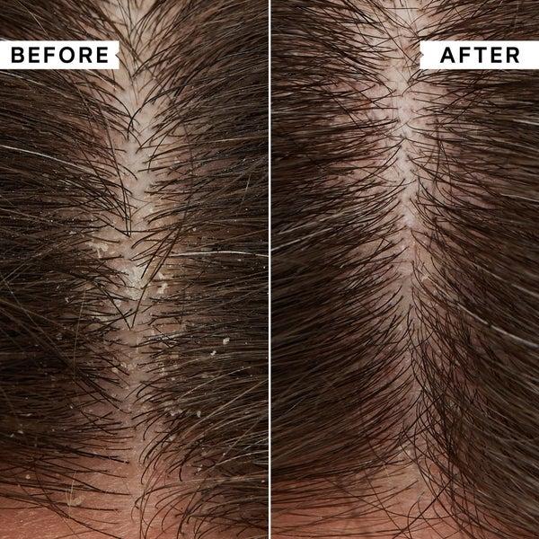 Philip Kingsley Philip Kingsley Flaky Itchy Scalp Shampoo 1000ml - (del valore di £ 88.00) Vendite Flash