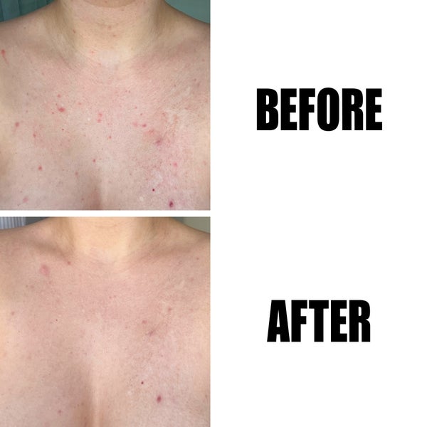 The INKEY List The INKEY List Glycolic Acid Exfoliating Body Stick 45g Offerta