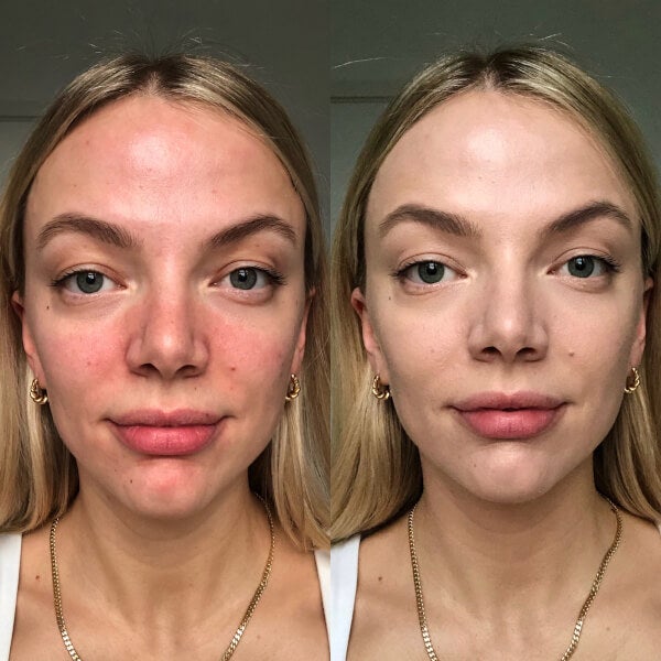 Dr.Jart+ Dr.Jart+ Cicapair Tiger Grass Color Correcting Treatment 15ml Vendita Calda