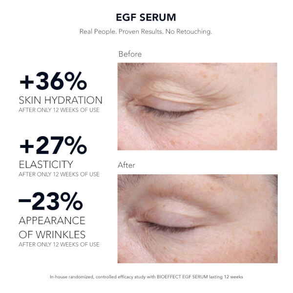 BIOEFFECT BIOEFFECT EGF Serum 15ml Offerta speciale della fabbrica
