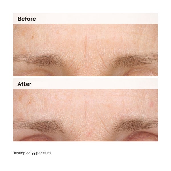 The Ordinary The Ordinary Retinal 0.2% Emulsion 15ml Latest fashion