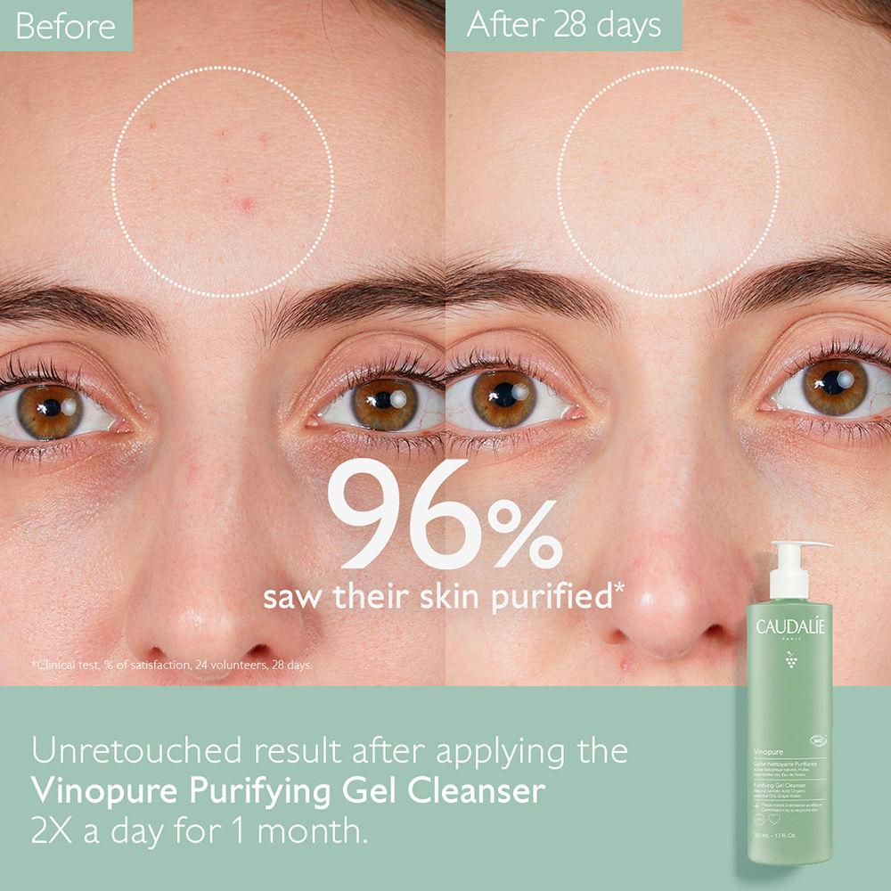 Caudalie VINOPURE Gelatina detergente purificante Vendita Calda
